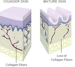 Does Your Skin have to Wrinkle with Age? Does Your Skin have to Wrinkle with Age?