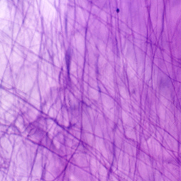 Elastin Elastin